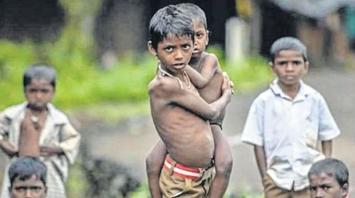 పిల్లల్లో IBDతో పోషకాహార లోపం.. ముఖ్యంగా క్రోన్స్ వ్యాధిలో అధికం: అధ్యయనం