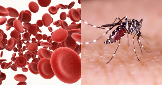 Doctors Urge These Precautions When Platelet Counts Drop in Dengue