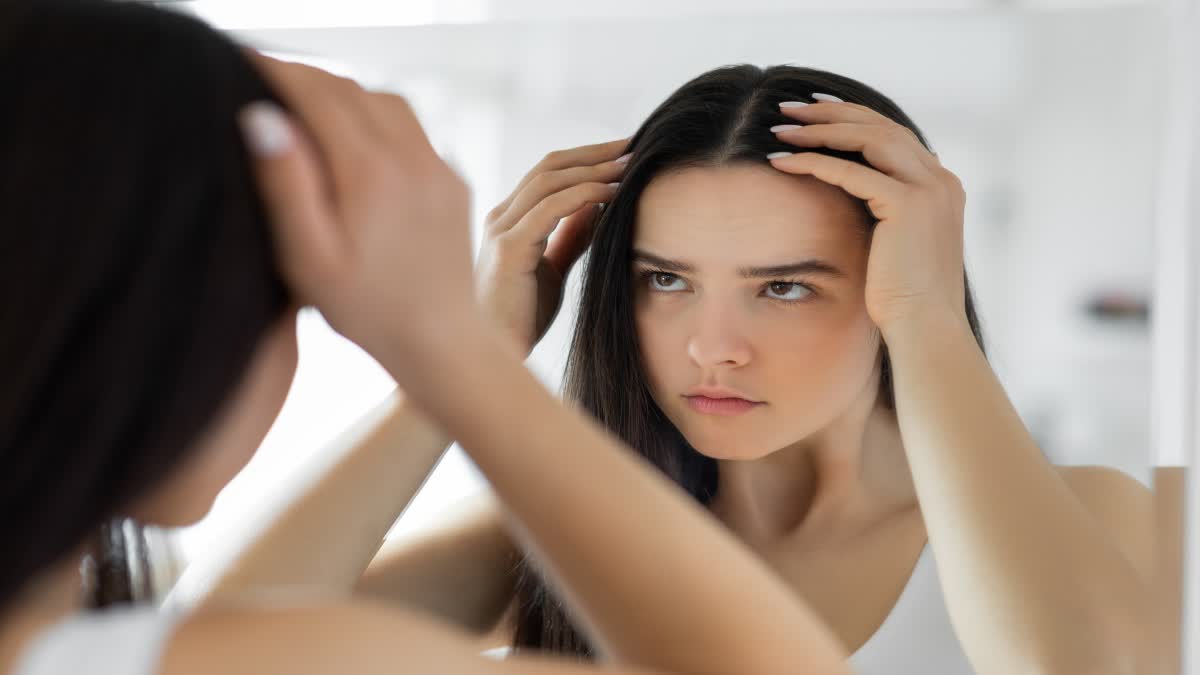 Don’t Ignore Dandruff, Experts Warn