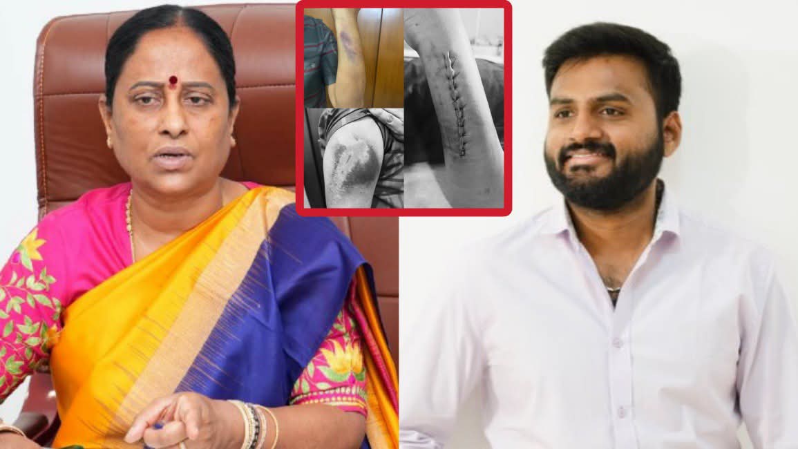 Attempted Murder Case Filed Against Konda Surekha’s Former OSD