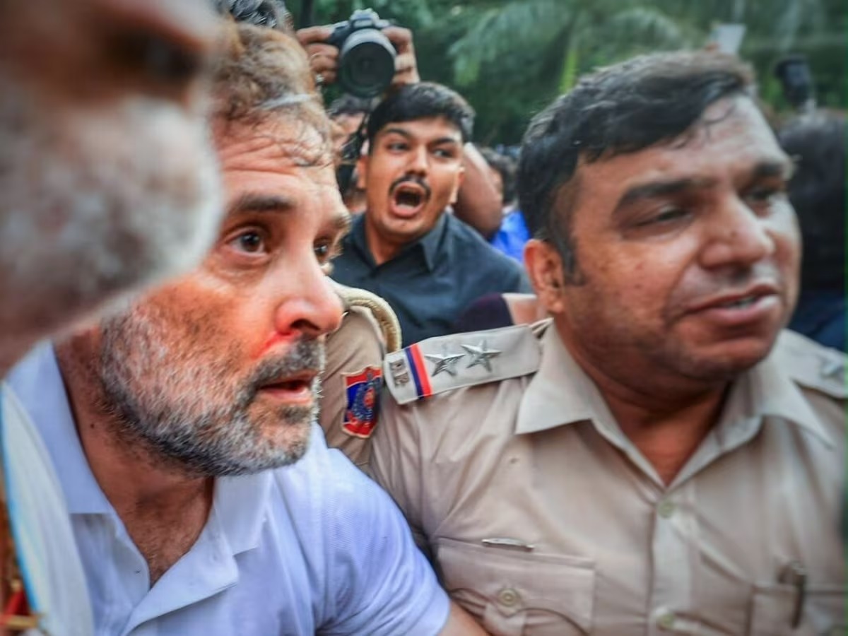 Rahul Gandhi Injured During Police Detention